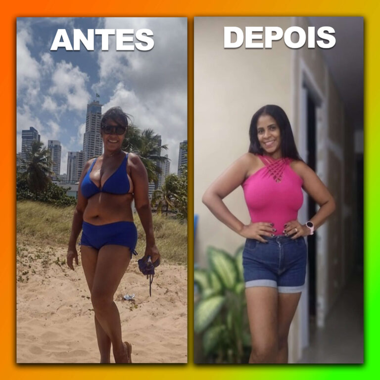 Antes e Depois #1