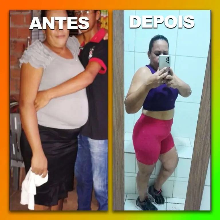 Antes e Depois #4